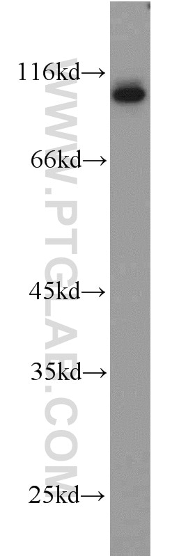 Western Blot (WB) analysis of mouse brain tissue using CD39/ENTPD1 Polyclonal antibody (19229-1-AP)