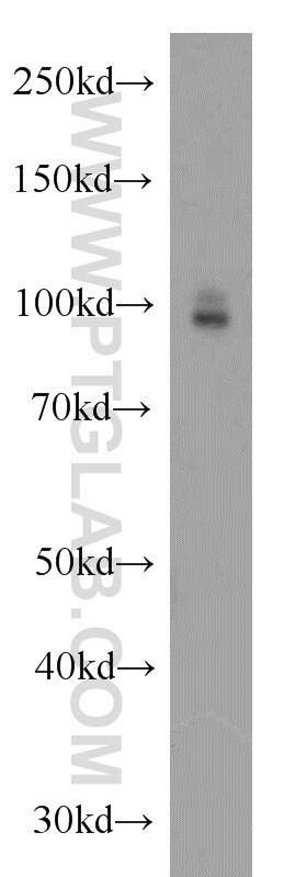 Western Blot (WB) analysis of mouse brain tissue using CD39/ENTPD1 Polyclonal antibody (19229-1-AP)