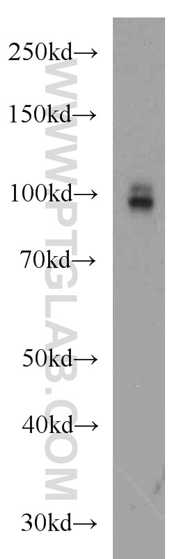Western Blot (WB) analysis of mouse brain tissue using CD39/ENTPD1 Polyclonal antibody (19229-1-AP)