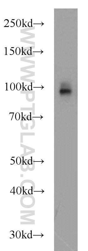 Western Blot (WB) analysis of mouse brain tissue using CD39/ENTPD1 Polyclonal antibody (19229-1-AP)