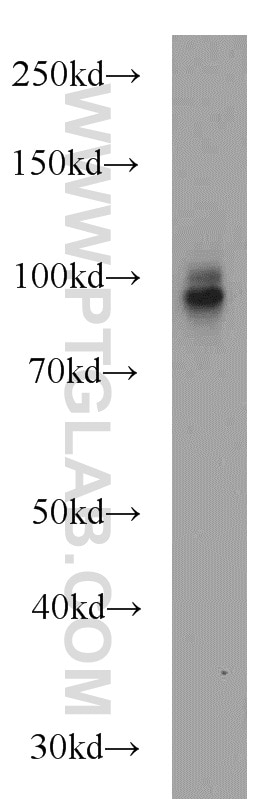 Western Blot (WB) analysis of mouse brain tissue using CD39/ENTPD1 Polyclonal antibody (19229-1-AP)