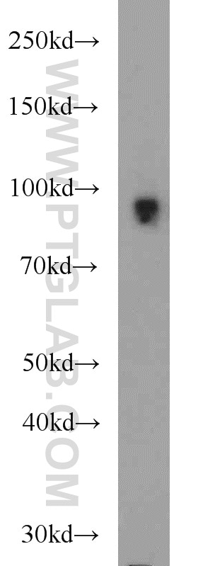 Western Blot (WB) analysis of mouse liver tissue using CD39/ENTPD1 Polyclonal antibody (19229-1-AP)