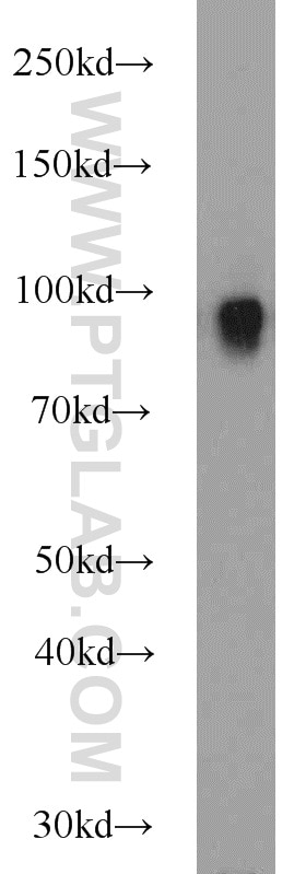 Western Blot (WB) analysis of mouse liver tissue using CD39/ENTPD1 Polyclonal antibody (19229-1-AP)