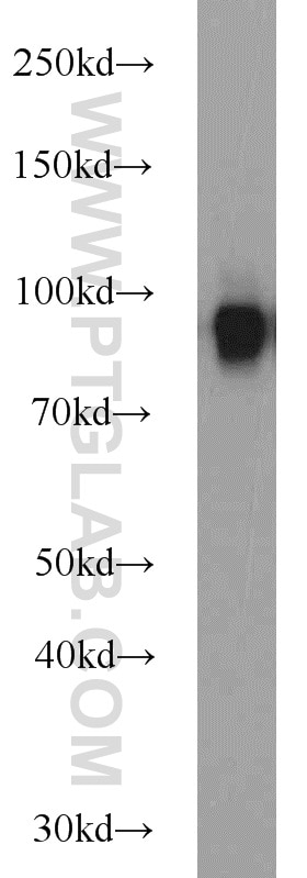 Western Blot (WB) analysis of mouse liver tissue using CD39/ENTPD1 Polyclonal antibody (19229-1-AP)
