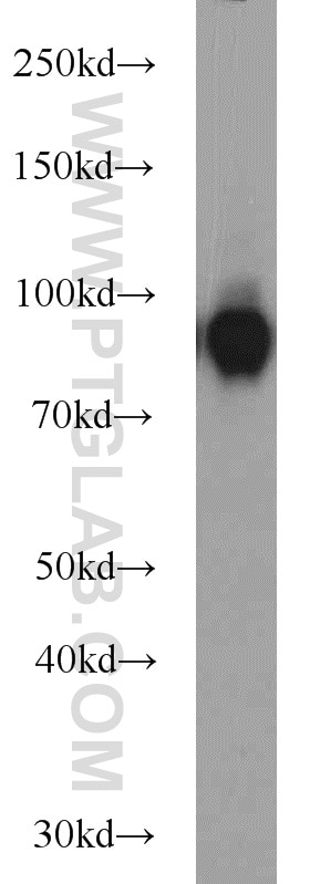 Western Blot (WB) analysis of mouse liver tissue using CD39/ENTPD1 Polyclonal antibody (19229-1-AP)