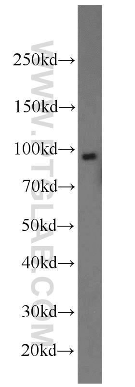 Western Blot (WB) analysis of human liver tissue using CD39/ENTPD1 Polyclonal antibody (19229-1-AP)