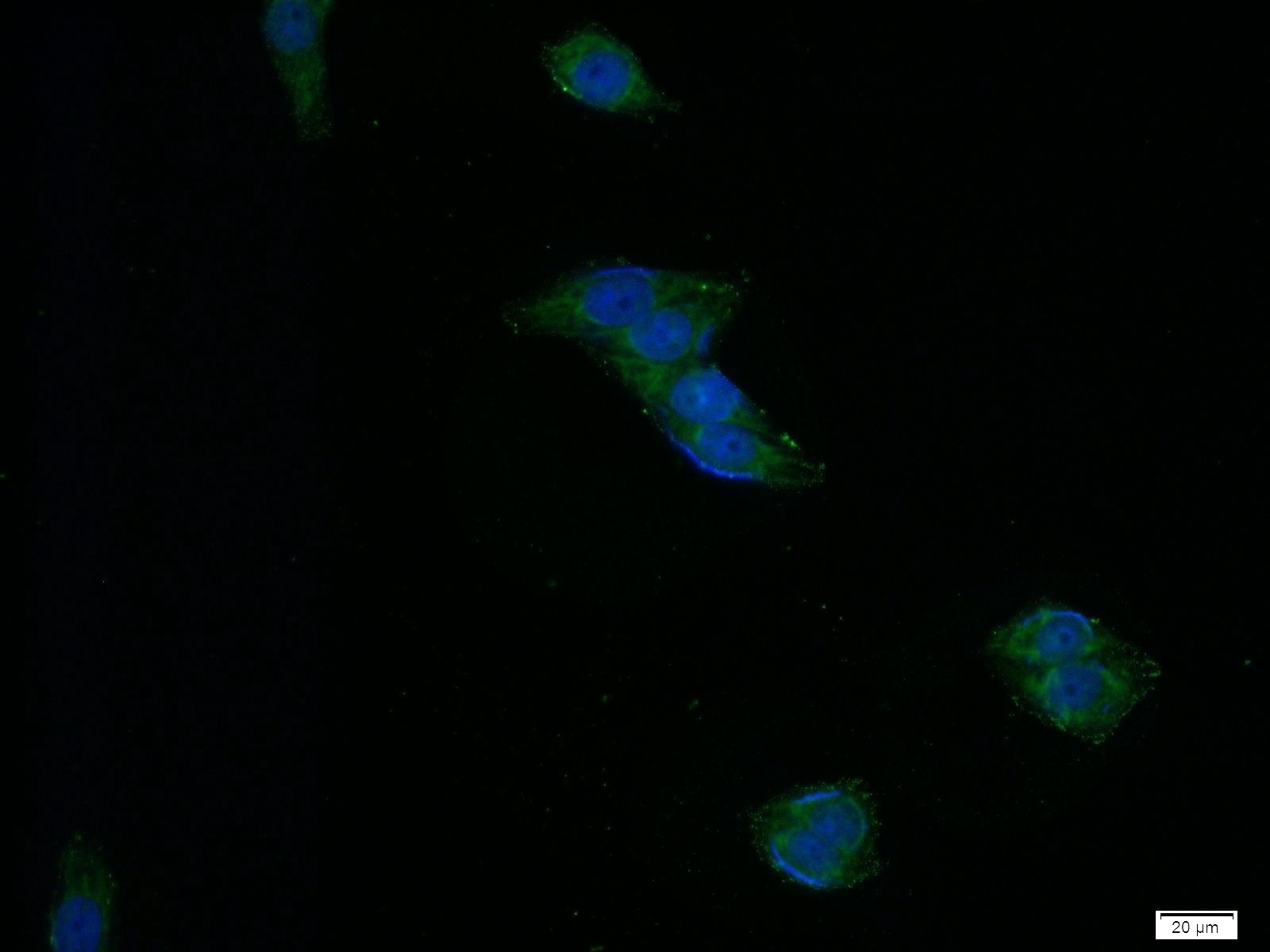 Immunofluorescence (IF) / fluorescent staining of HeLa cells using CD39/ENTPD1 Monoclonal antibody (60323-1-Ig)