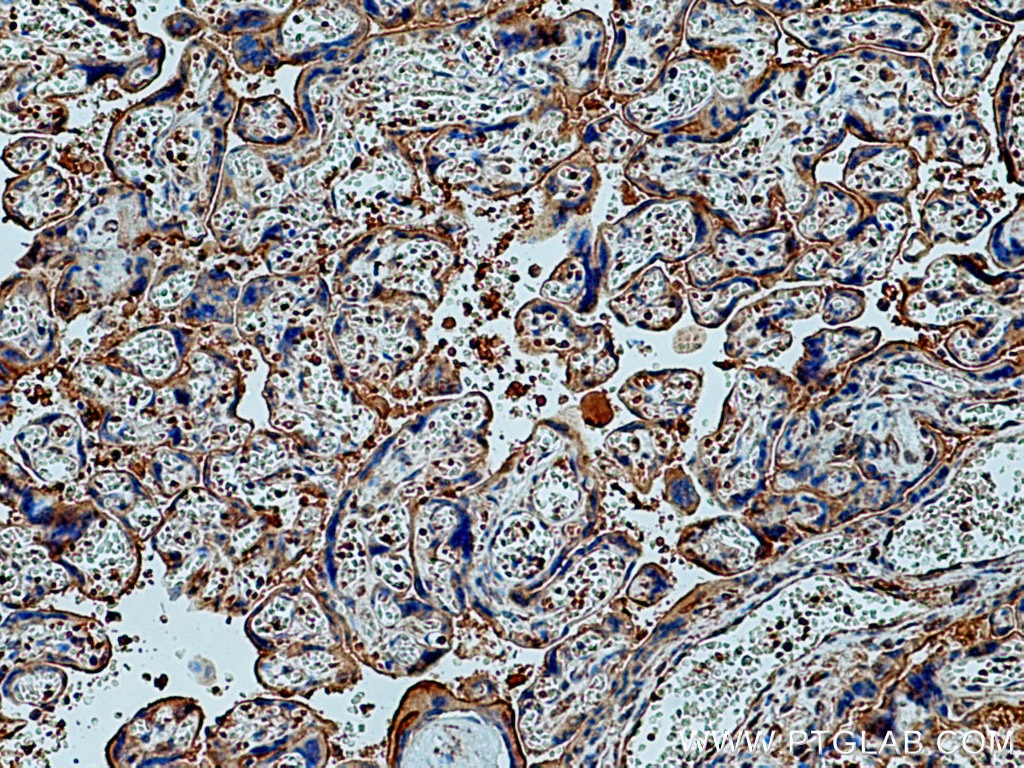 IHC staining of human placenta using 60323-1-Ig