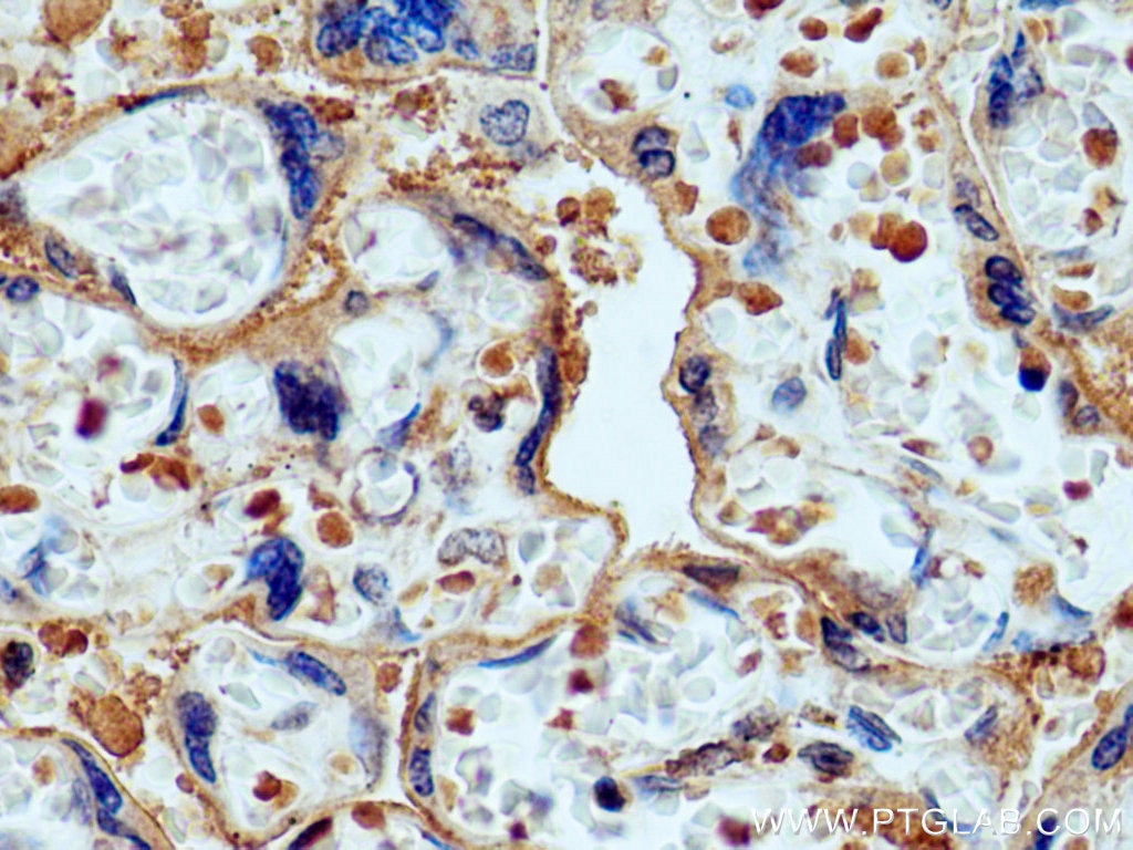 Immunohistochemistry (IHC) staining of human placenta tissue using CD39/ENTPD1 Monoclonal antibody (60323-1-Ig)