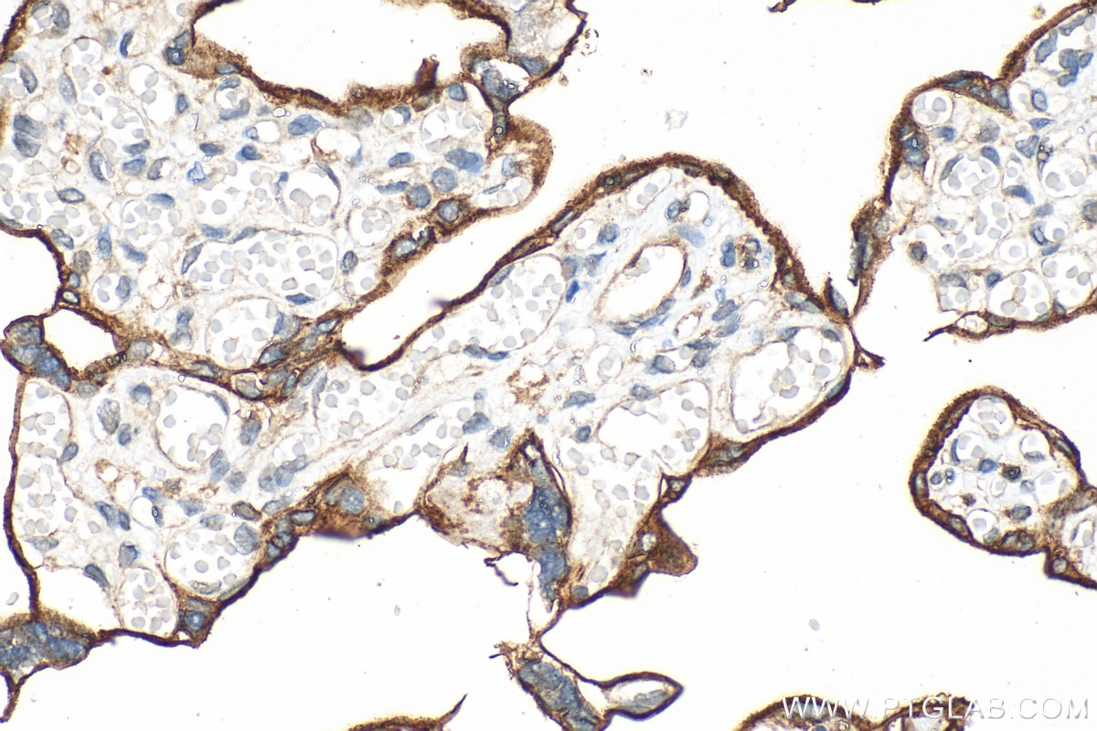 Immunohistochemistry (IHC) staining of human placenta tissue using CD39/ENTPD1 Monoclonal antibody (60323-1-Ig)