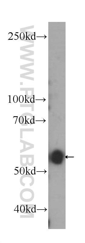 Western Blot (WB) analysis of Jurkat cells using CD39/ENTPD1 Monoclonal antibody (60323-1-Ig)