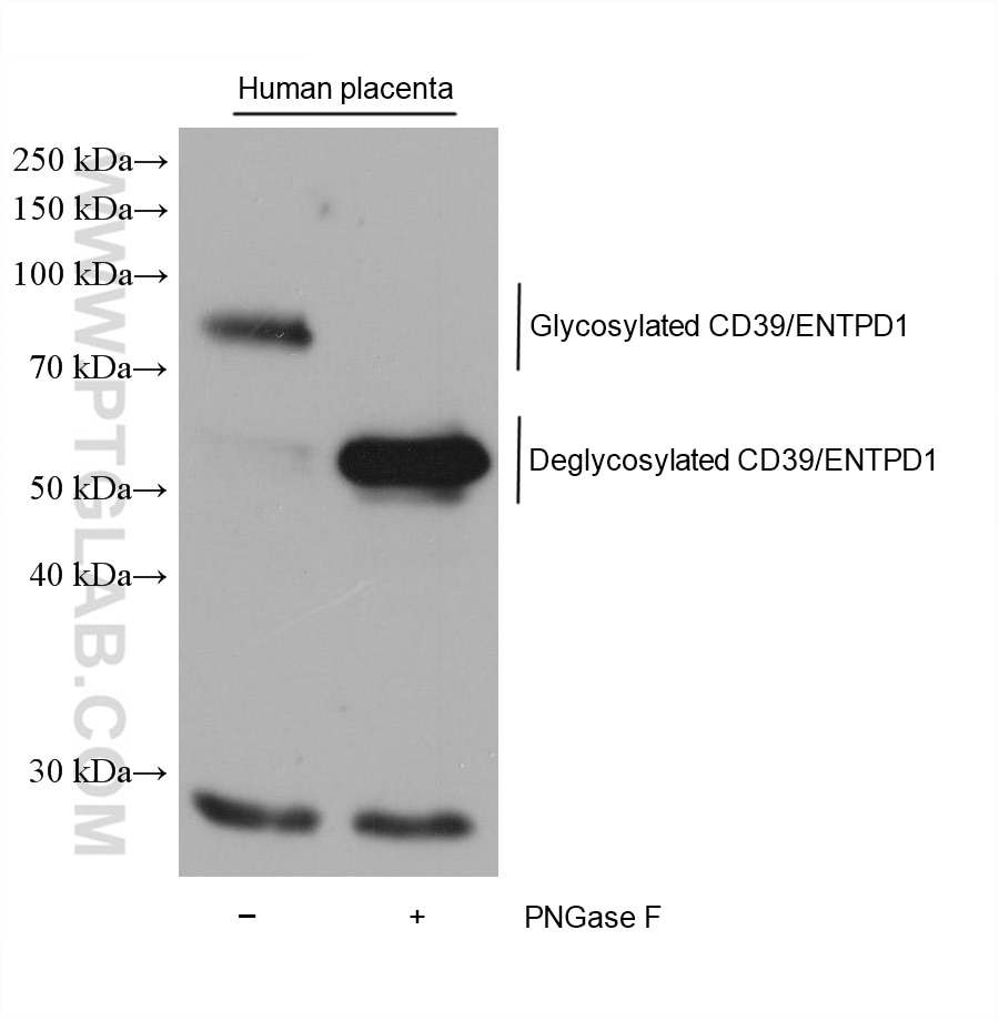 Western Blot (WB) analysis of various lysates using CD39/ENTPD1 Monoclonal antibody (60323-1-Ig)