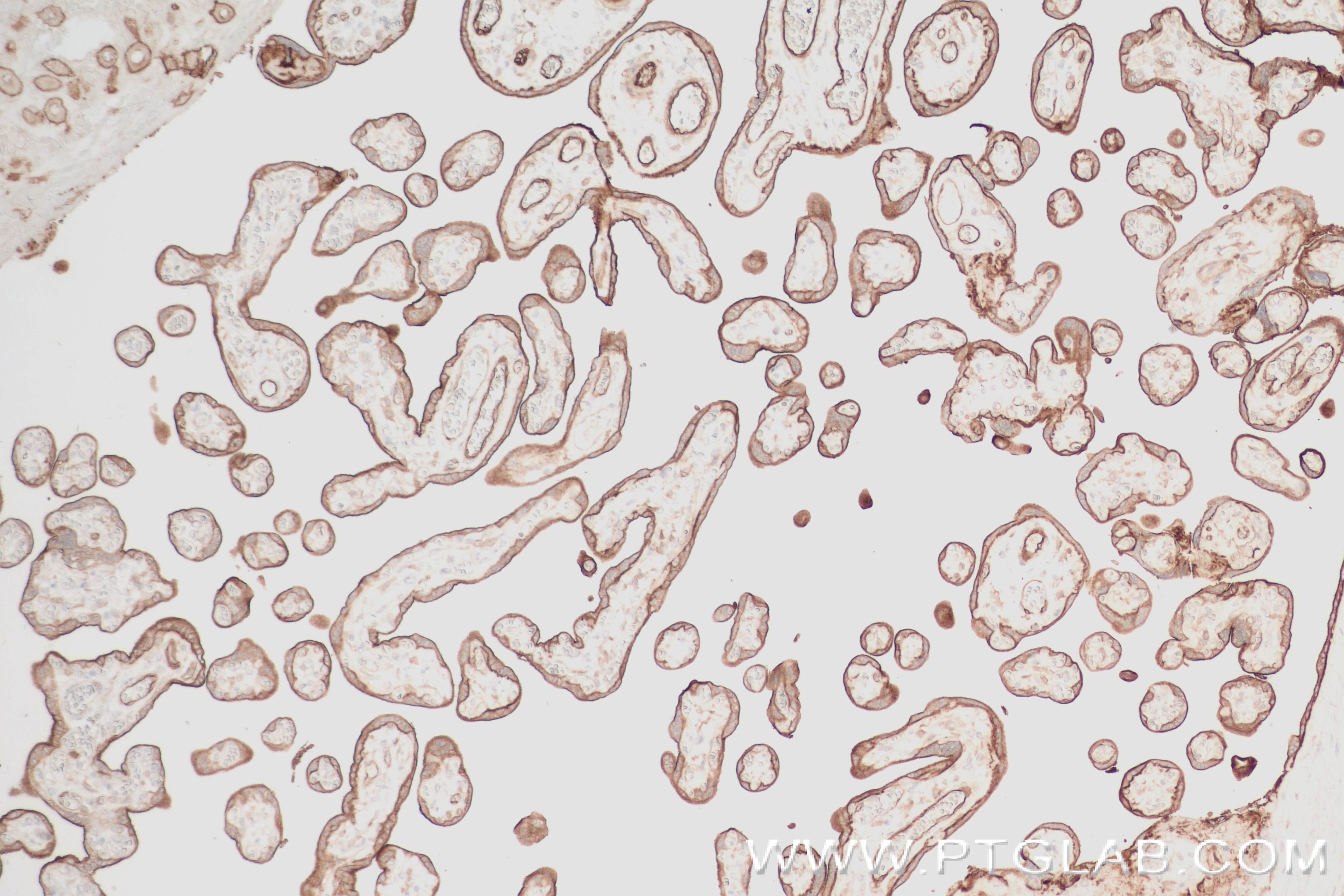 Immunohistochemistry (IHC) staining of human placenta tissue using ENTPD1 Recombinant antibody (84235-4-RR)