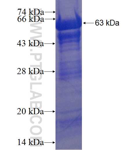ENTPD1 fusion protein Ag5429 SDS-PAGE