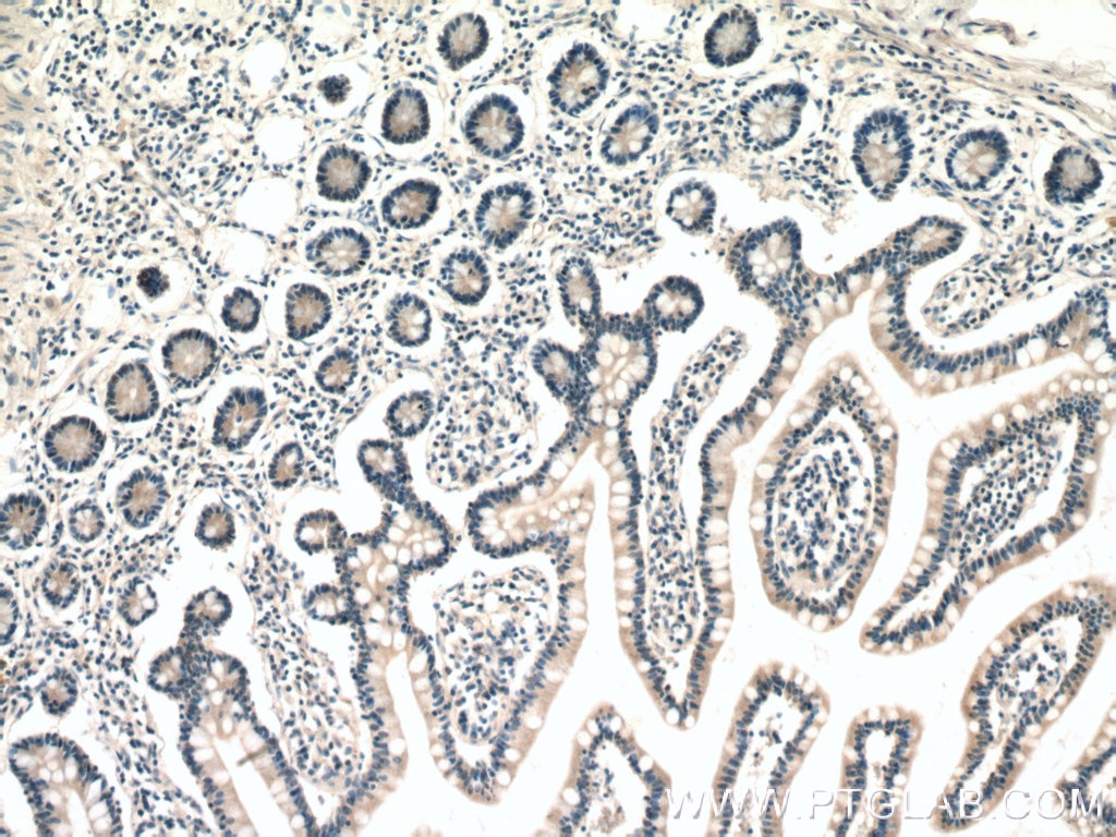 Immunohistochemistry (IHC) staining of human small intestine tissue using ENTPD2 Polyclonal antibody (13656-1-AP)