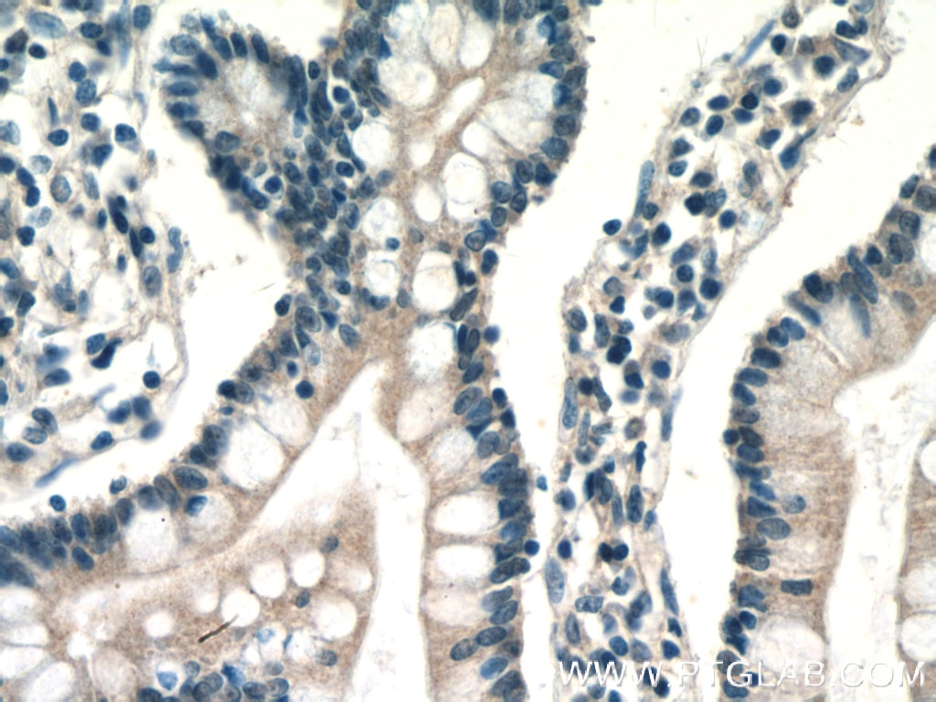 Immunohistochemistry (IHC) staining of human small intestine tissue using ENTPD2 Polyclonal antibody (13656-1-AP)