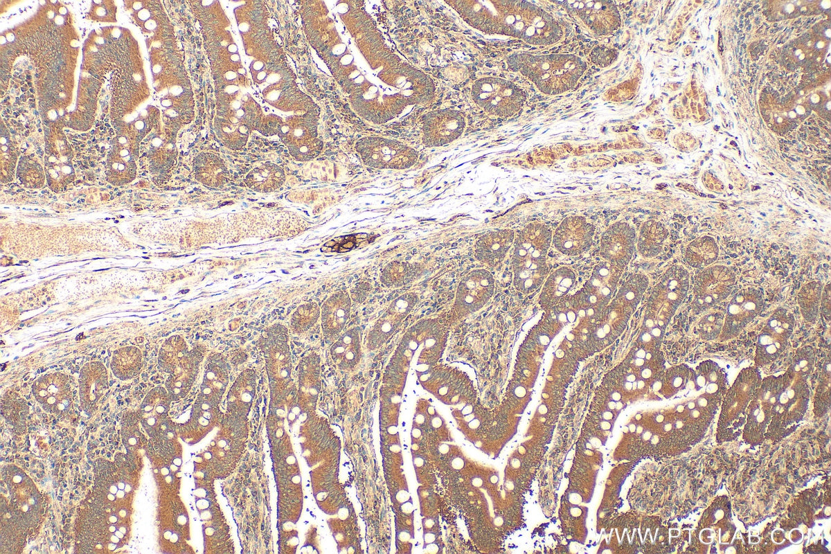 IHC staining of human small intestine using 13656-1-AP Immunohistochemistry (IHC) staining of human small intestine tissue using ENTPD2 Polyclonal antibody (13656-1-AP)
