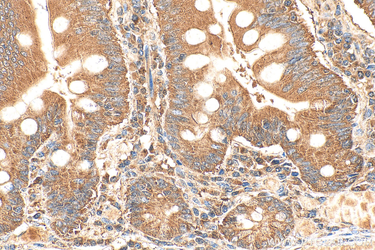 IHC staining of human small intestine using 13656-1-AP Immunohistochemistry (IHC) staining of human small intestine tissue using ENTPD2 Polyclonal antibody (13656-1-AP)