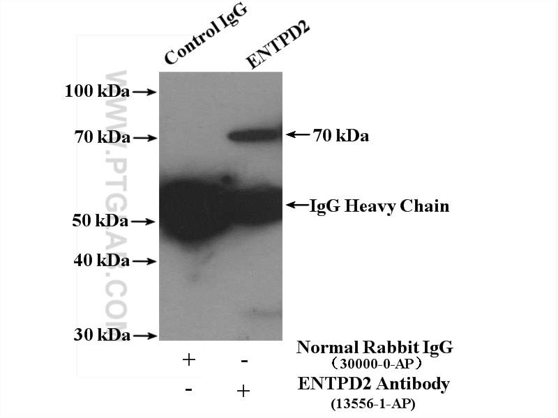 Immunoprecipitation (IP) experiment of K-562 cells using ENTPD2 Polyclonal antibody (13656-1-AP)