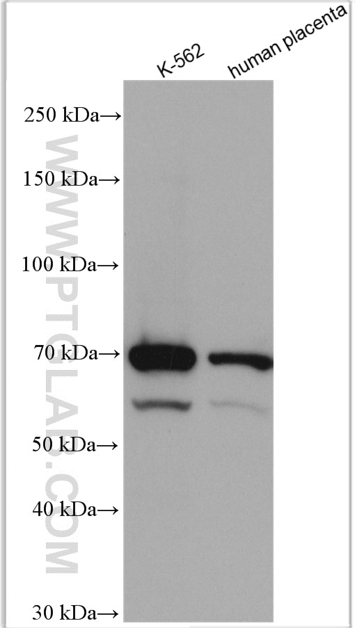 Western Blot (WB) analysis of various lysates using ENTPD2 Polyclonal antibody (13656-1-AP)