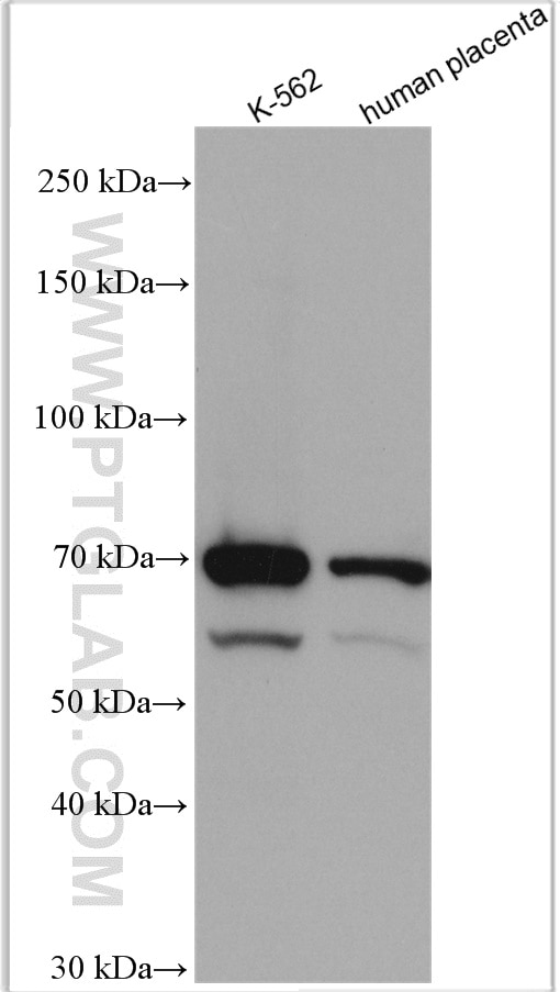 WB analysis using 13656-1-AP