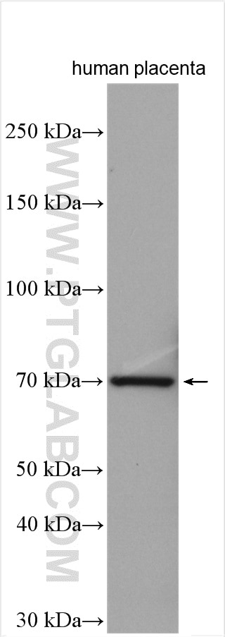 Western Blot (WB) analysis of human placenta tissue using ENTPD2 Polyclonal antibody (13656-1-AP)