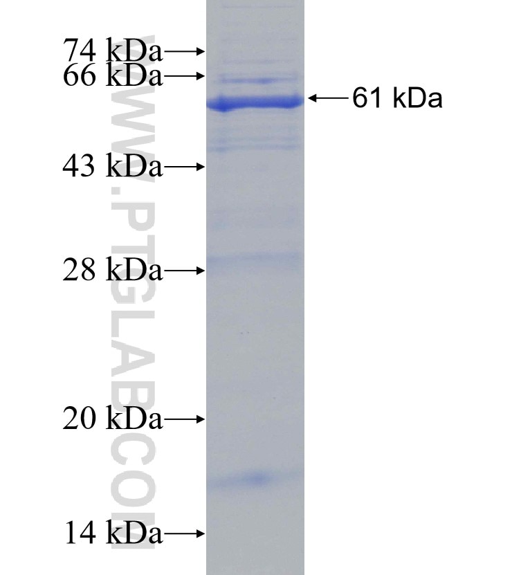 ENTPD2 fusion protein Ag4513 SDS-PAGE