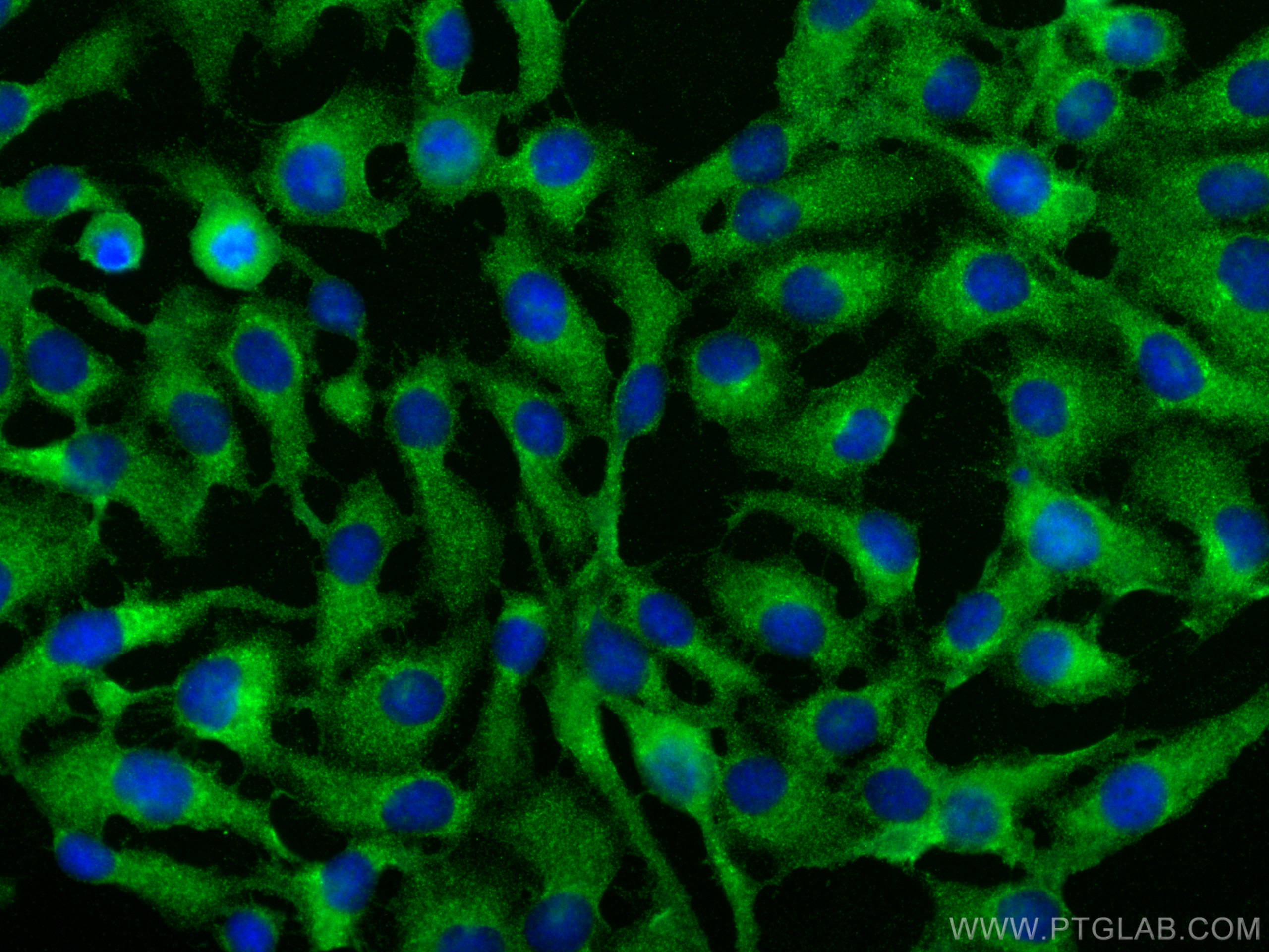 Immunofluorescence (IF) / fluorescent staining of U2OS cells using ENTPD3 Polyclonal antibody (13021-1-AP)