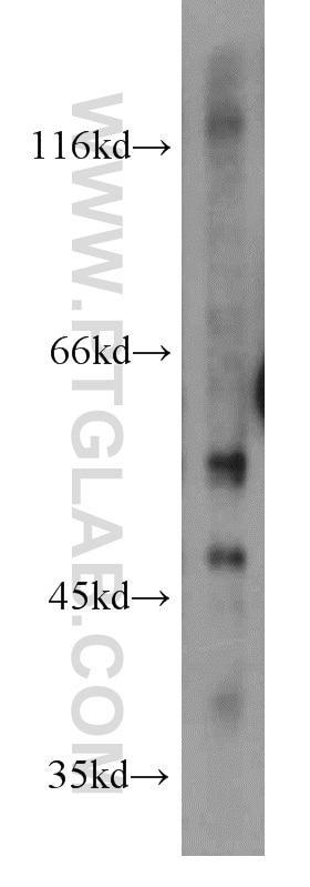 Western Blot (WB) analysis of Jurkat cells using ENTPD3 Polyclonal antibody (13021-1-AP)