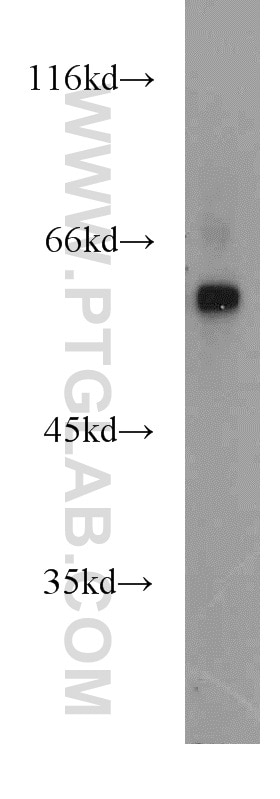 Western Blot (WB) analysis of Raji cells using ENTPD3 Polyclonal antibody (13021-1-AP)