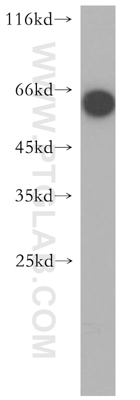 Western Blot (WB) analysis of human brain tissue using ENTPD3 Polyclonal antibody (13021-1-AP)