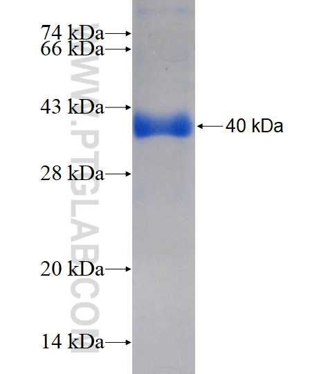 ENTPD3 fusion protein Ag4114 SDS-PAGE