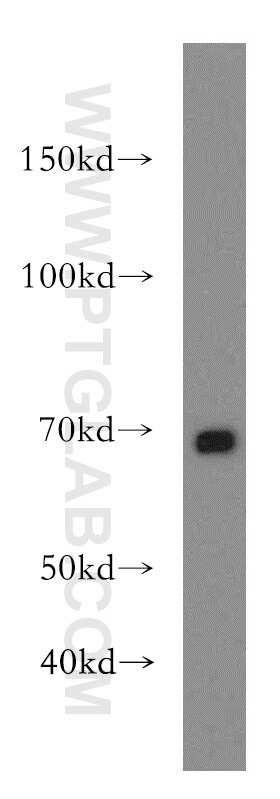 Western Blot (WB) analysis of Jurkat cells using ENTPD4 Polyclonal antibody (19597-1-AP)