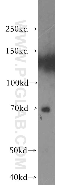 Western Blot (WB) analysis of human placenta tissue using ENTPD4 Polyclonal antibody (19597-1-AP)