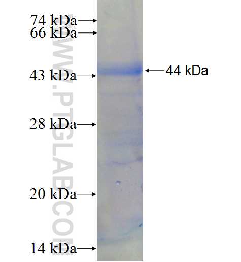 ENTPD4 fusion protein Ag5175 SDS-PAGE