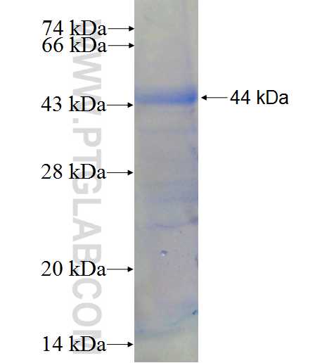 ENTPD4 fusion protein Ag5175 SDS-PAGE
