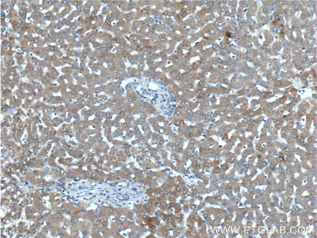 Immunohistochemistry (IHC) staining of human liver tissue using ENTPD5 Polyclonal antibody (26746-1-AP)