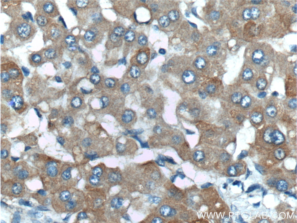 Immunohistochemistry (IHC) staining of human liver tissue using ENTPD5 Polyclonal antibody (26746-1-AP)