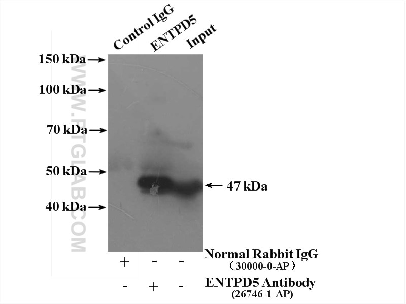 Immunoprecipitation (IP) experiment of mouse liver tissue using ENTPD5 Polyclonal antibody (26746-1-AP)