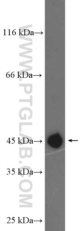 Western Blot (WB) analysis of mouse liver tissue using ENTPD5 Polyclonal antibody (26746-1-AP)