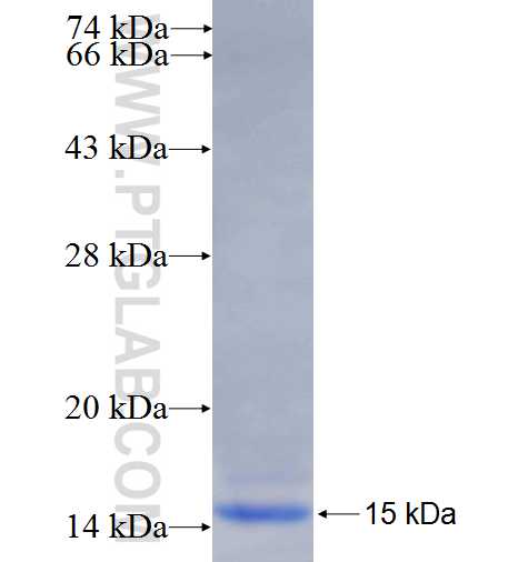 ENTPD5 fusion protein Ag25022 SDS-PAGE