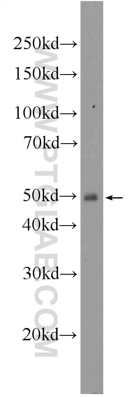 Western Blot (WB) analysis of mouse spleen tissue using ENTPD6 Polyclonal antibody (11626-1-AP)