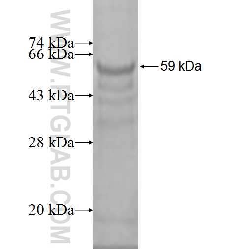 ENTPD6 fusion protein Ag2148 SDS-PAGE