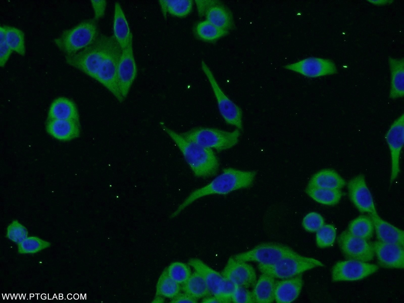 Immunofluorescence (IF) / fluorescent staining of HeLa cells using ENTPD7 Polyclonal antibody (24558-1-AP)