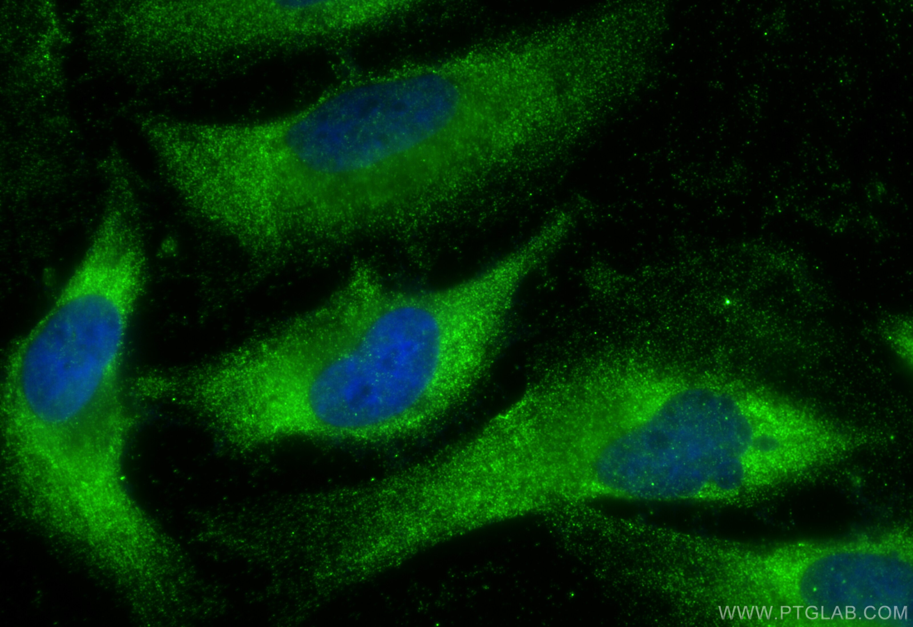 Immunofluorescence (IF) / fluorescent staining of HeLa cells using ENTPD7 Polyclonal antibody (24558-1-AP)