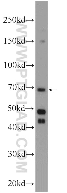 Western Blot (WB) analysis of HeLa cells using ENTPD7 Polyclonal antibody (24558-1-AP)