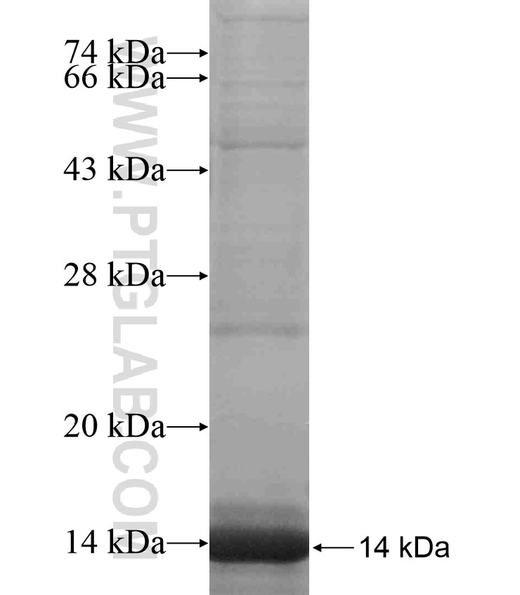 ENTPD7 fusion protein Ag18417 SDS-PAGE