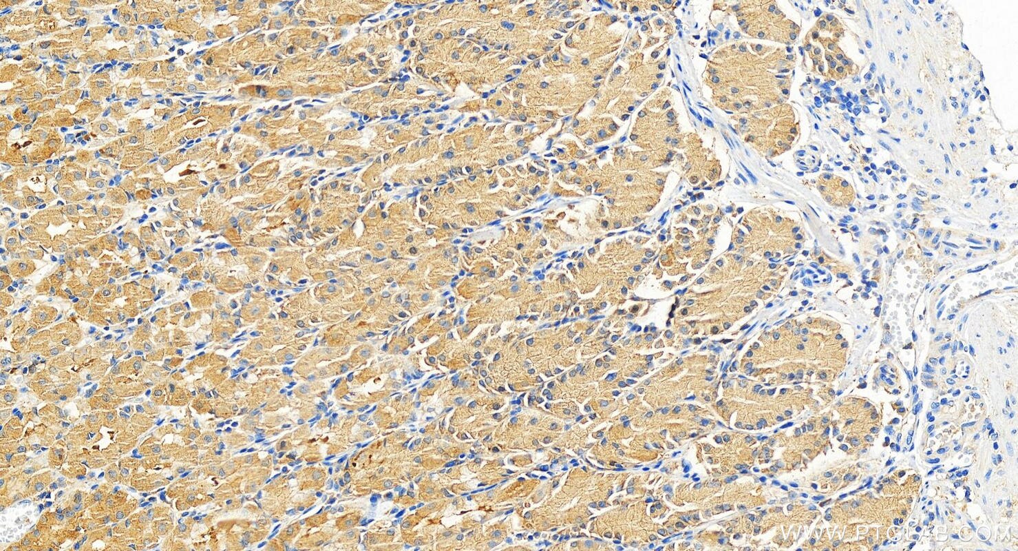 Immunohistochemistry (IHC) staining of human stomach tissue using ENTPD8 Polyclonal antibody (18848-1-AP)