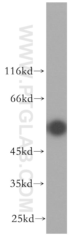 Western Blot (WB) analysis of HepG2 cells using ENTPD8 Polyclonal antibody (18848-1-AP)