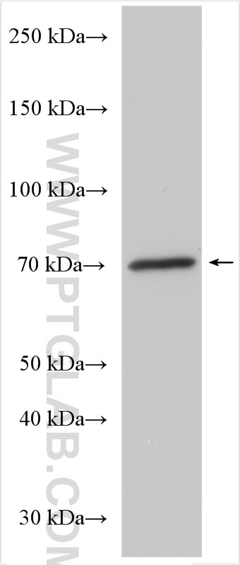Western Blot (WB) analysis of rat liver tissue using ENTPD8 Polyclonal antibody (21010-1-AP)